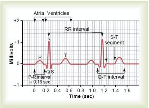 normal ecg report|How to Read an ECG .